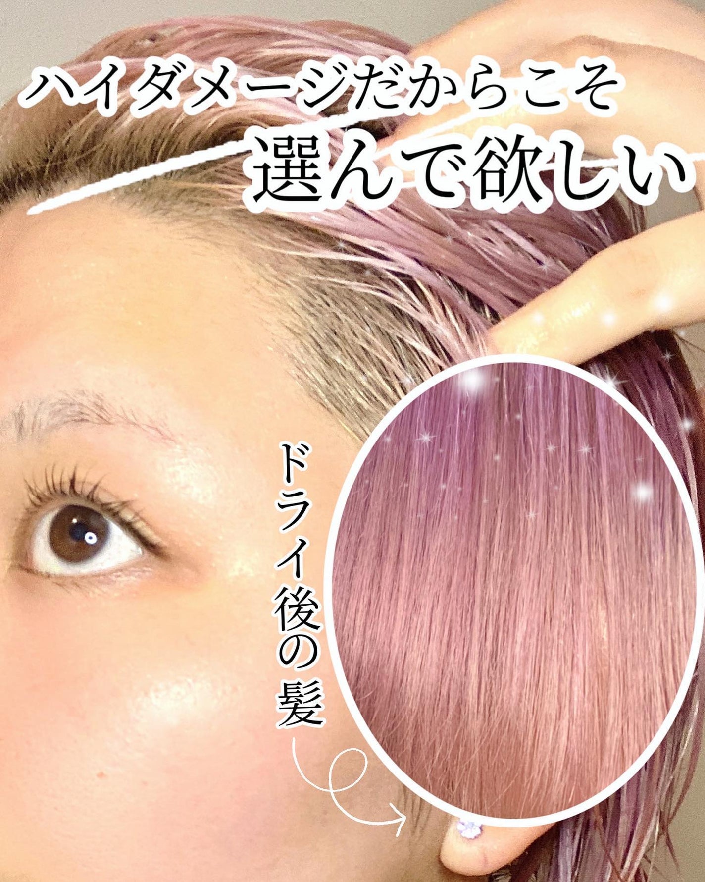 フォルテ アンプル トリートメント/treecell/洗い流すヘアトリートメントを使ったクチコミ(4枚目)