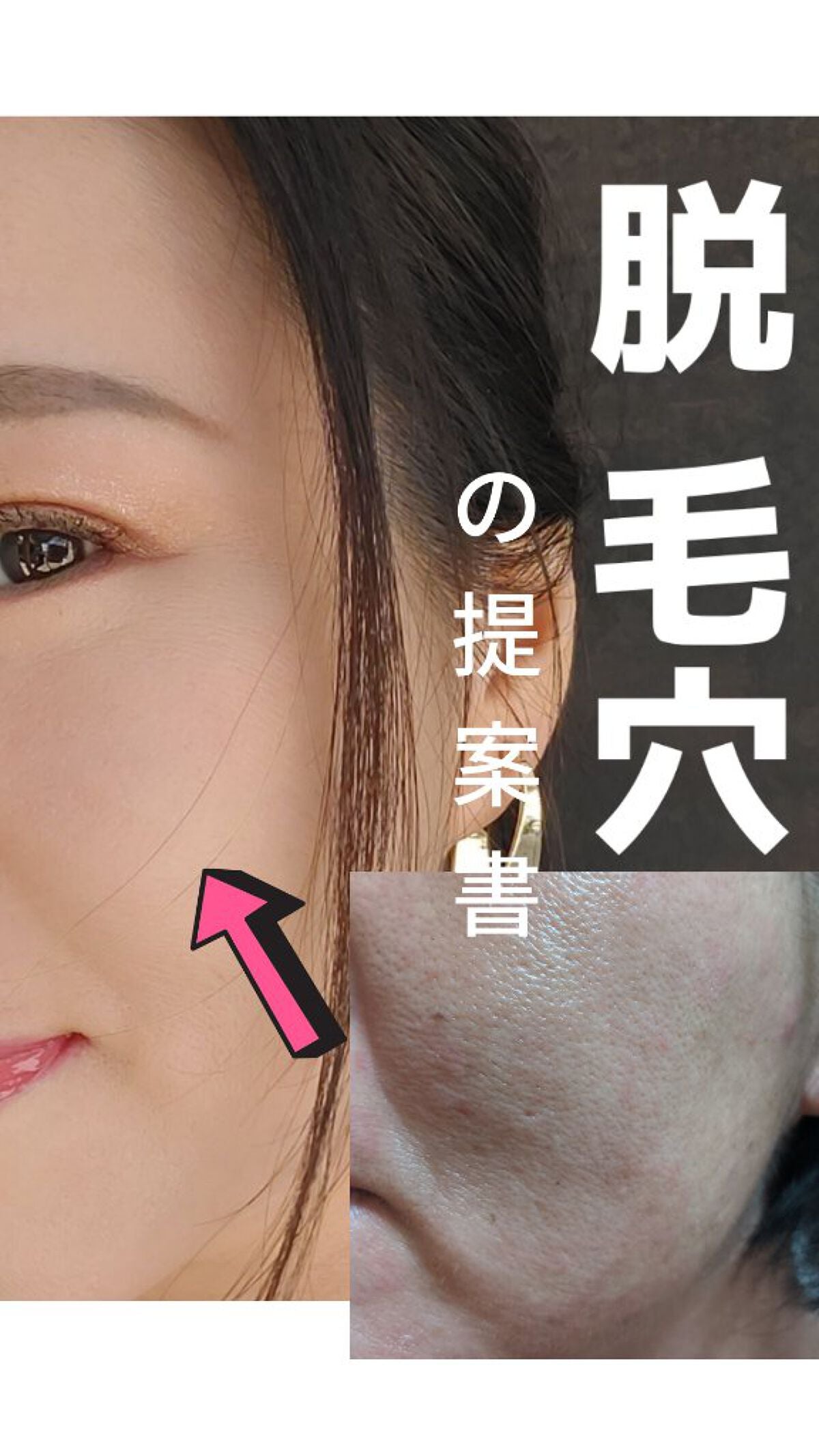 美肌カウンセラー💆肌悩みを解決し見る世界を変える on LIPS 「つるんとしたたまご肌へ。写真は、ノー加工&ノーアプリの携帯内蔵..」(2枚目)