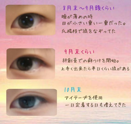 アイテープ(絆創膏タイプ、レギュラー、70枚)/DAISO/二重まぶた用アイテムを使ったクチコミ(2枚目)