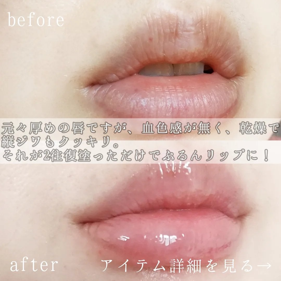 エッセンス リッププランパー/Visée/リッププランパーを使ったクチコミ(2枚目)