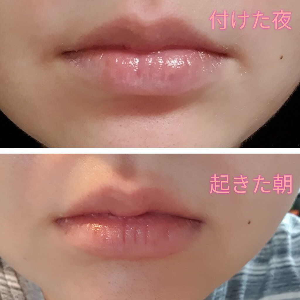 リップトリートメントバーム/LANEIGE/リップケアを使ったクチコミ（3枚目）