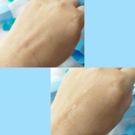 ACモイスト セット/iniks/スキンケアキットを使ったクチコミ(2枚目)