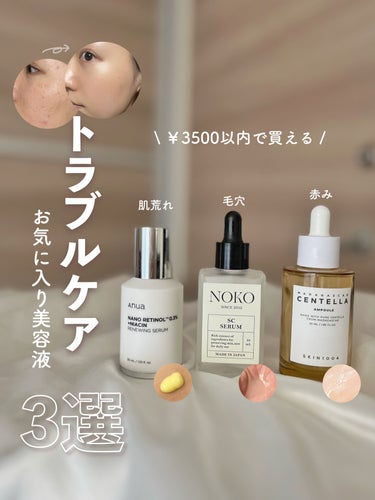 【3500円以内で買える】
トラブルケアにおすすめの美容液3選🫧


Anua
ナノレチノール0.3
ナイアシンニューイングセラム
30ml / ￥3200

濃厚本舗(NOKO)
SCセラム
ヒト幹細