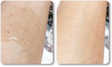 ナチュラルビオグロウセラム/LIALUSTER/美容液を使ったクチコミ(5枚目)