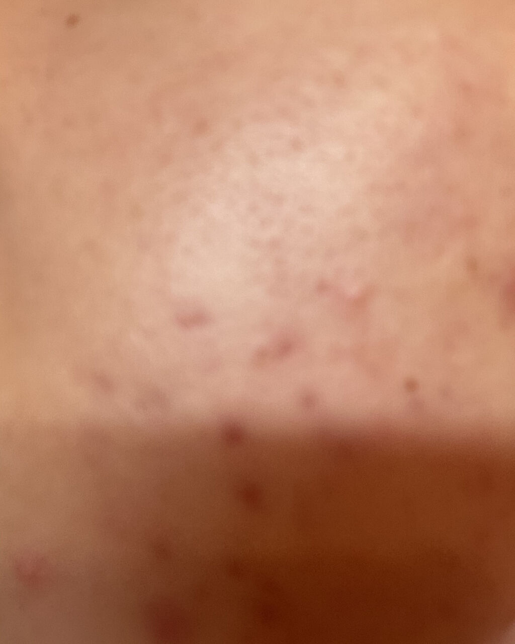 極潤 ヒアルロン液(旧)/肌ラボ/化粧水を使ったクチコミ（2枚目）