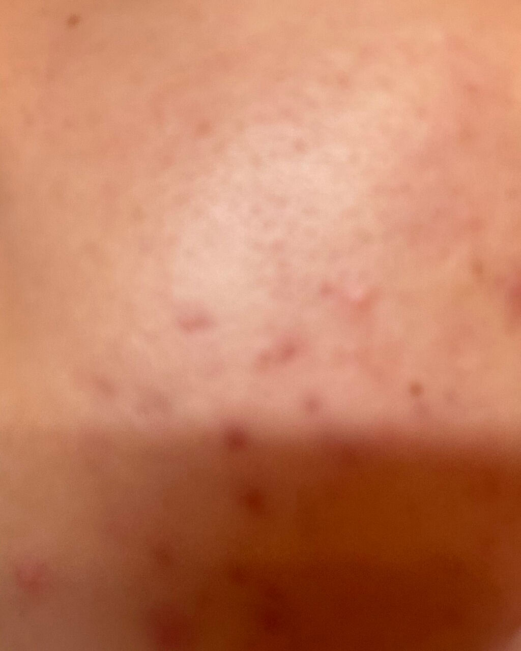 極潤 ヒアルロン液(旧)/肌ラボ/化粧水を使ったクチコミ(2枚目)