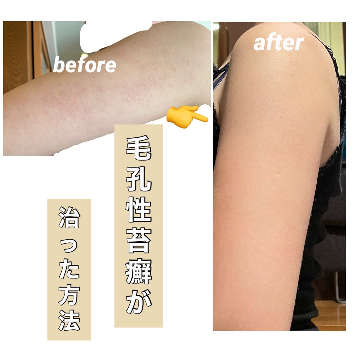 レチノールアドバンスドファーミングクリーム/ADVANCED CLINICALS/ボディクリームを使ったクチコミ（1枚目）