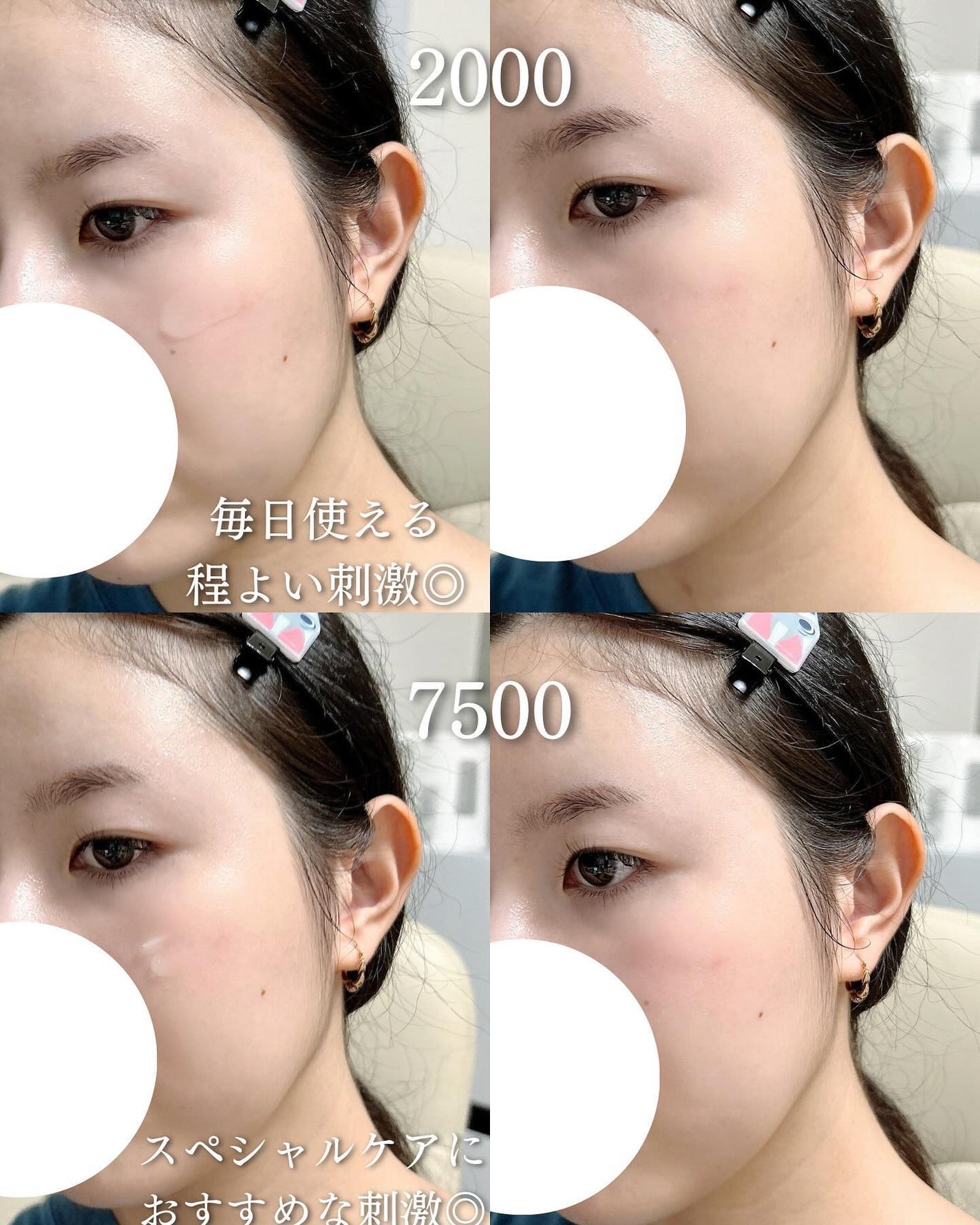 ゼロ1DAYエクソソームショット2000/MEDICUBE/美容液を使ったクチコミ(4枚目)