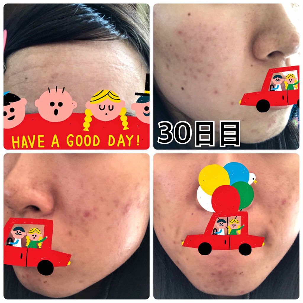 マイルドクレンジング オイル/ファンケル/オイルクレンジングを使ったクチコミ(4枚目)