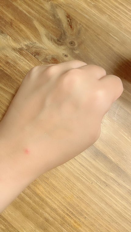 ドクダミ 77 スージングトナー/Anua/化粧水を使ったクチコミ(2枚目)