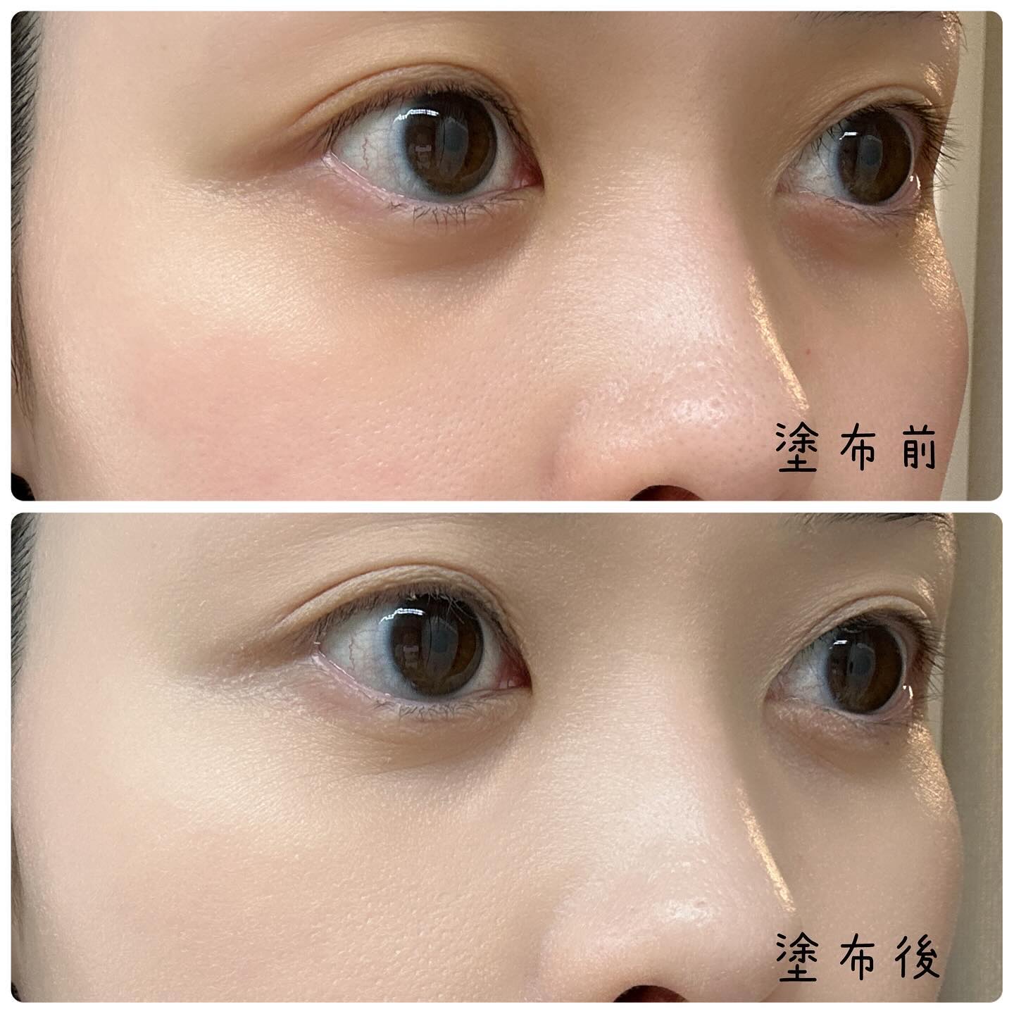 ラスティング クラリティ ルースパウダー/est/ルースパウダーを使ったクチコミ（3枚目）