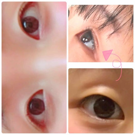 アイビューティー フィクサー WP/アストレア ヴィルゴ/二重まぶた用アイテムを使ったクチコミ(1枚目)