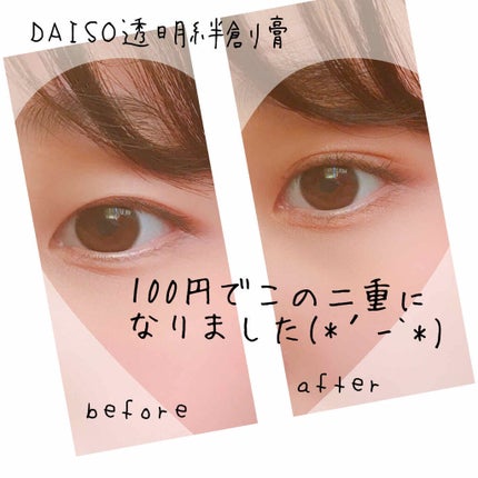 防水透明バン/DAISO/その他を使ったクチコミ(1枚目)