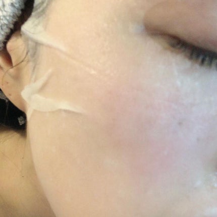 ピンクティーツリーマスクパック/APLIN/シートマスク・パックを使ったクチコミ(4枚目)