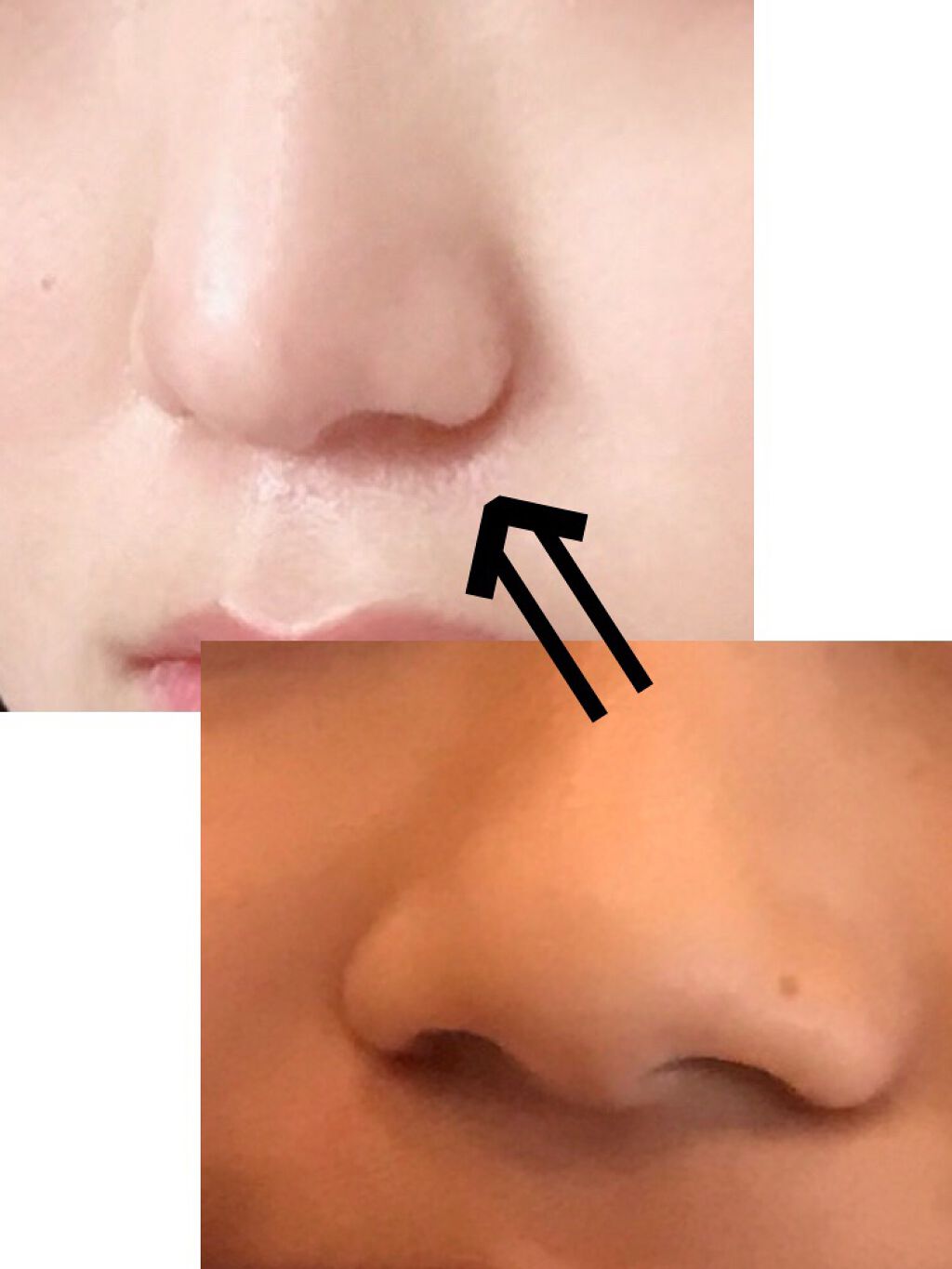 かっさプレート/DAISO/かっさプレートを使ったクチコミ（3枚目）