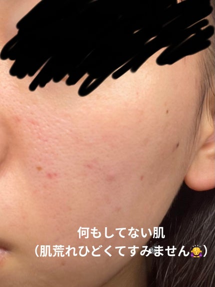 マシュマロフィニッシュパウダー ~Abloom~/キャンメイク/プレストパウダーを使ったクチコミ(3枚目)