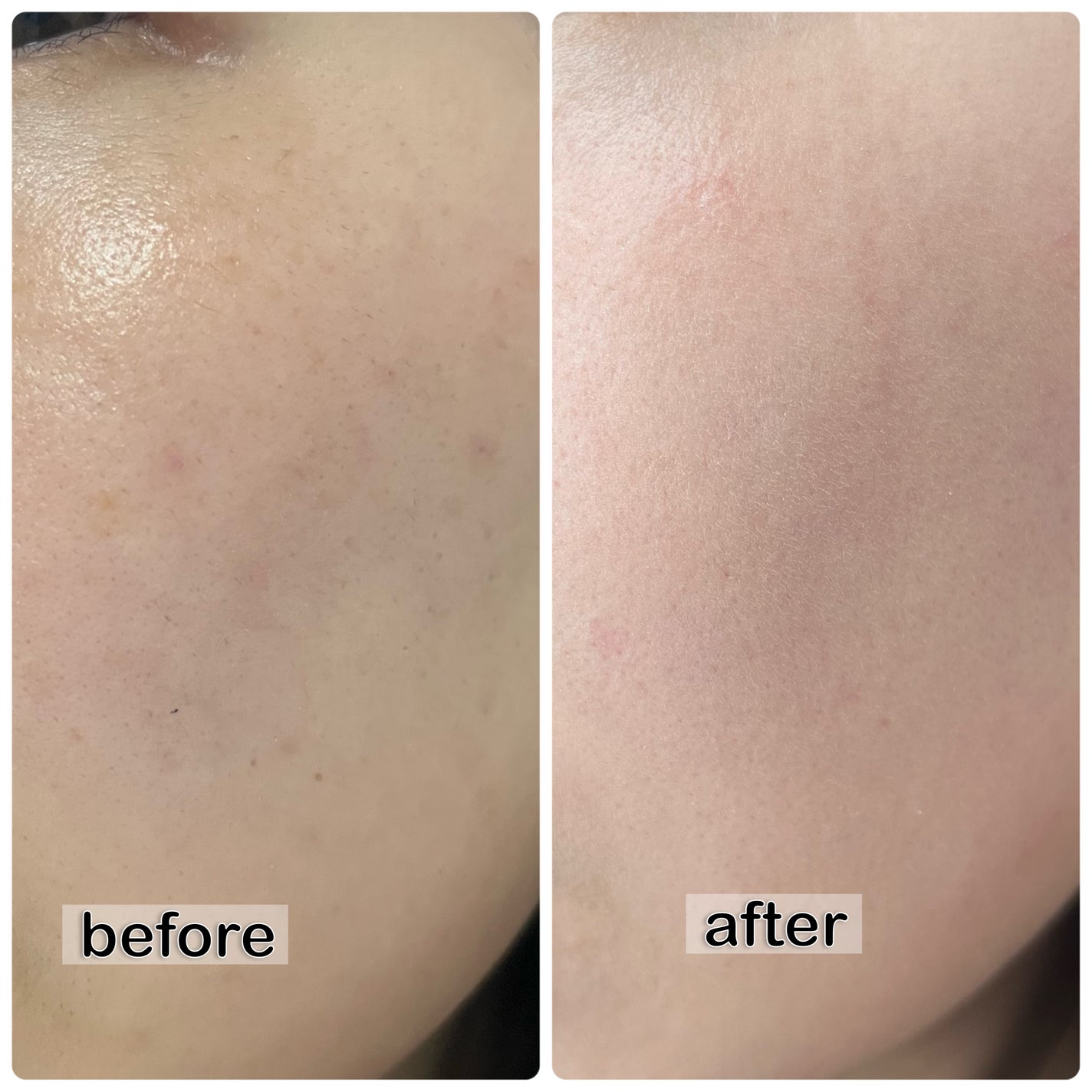 ピンクティーツリーカバークッション/APLIN/クッションファンデーションを使ったクチコミ(4枚目)