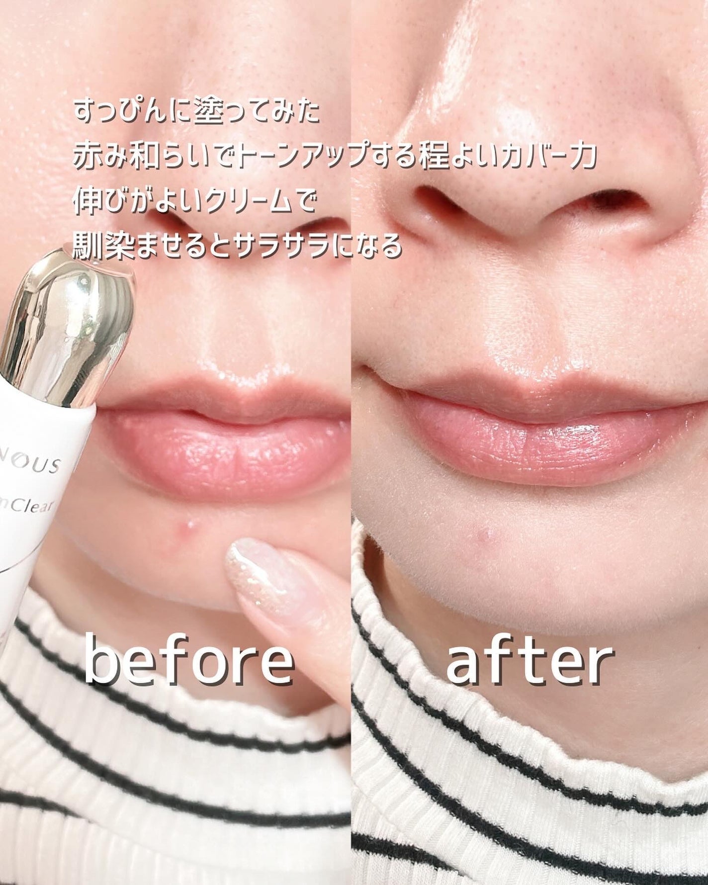 イプノス シーバムクリア リペアクリーム/ACSEINE/フェイスクリームを使ったクチコミ(5枚目)