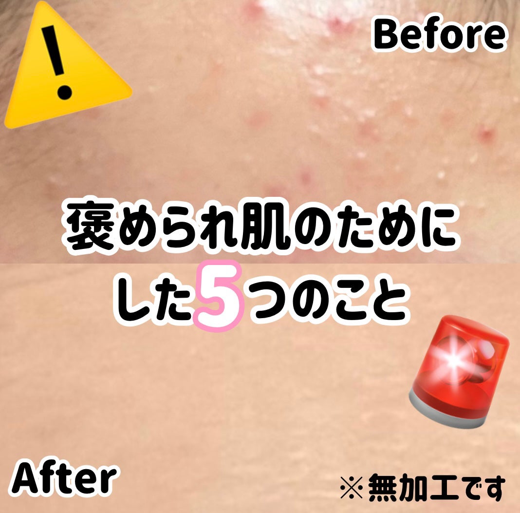 ピンクティーツリートナー/APLIN/化粧水を使ったクチコミ(1枚目)