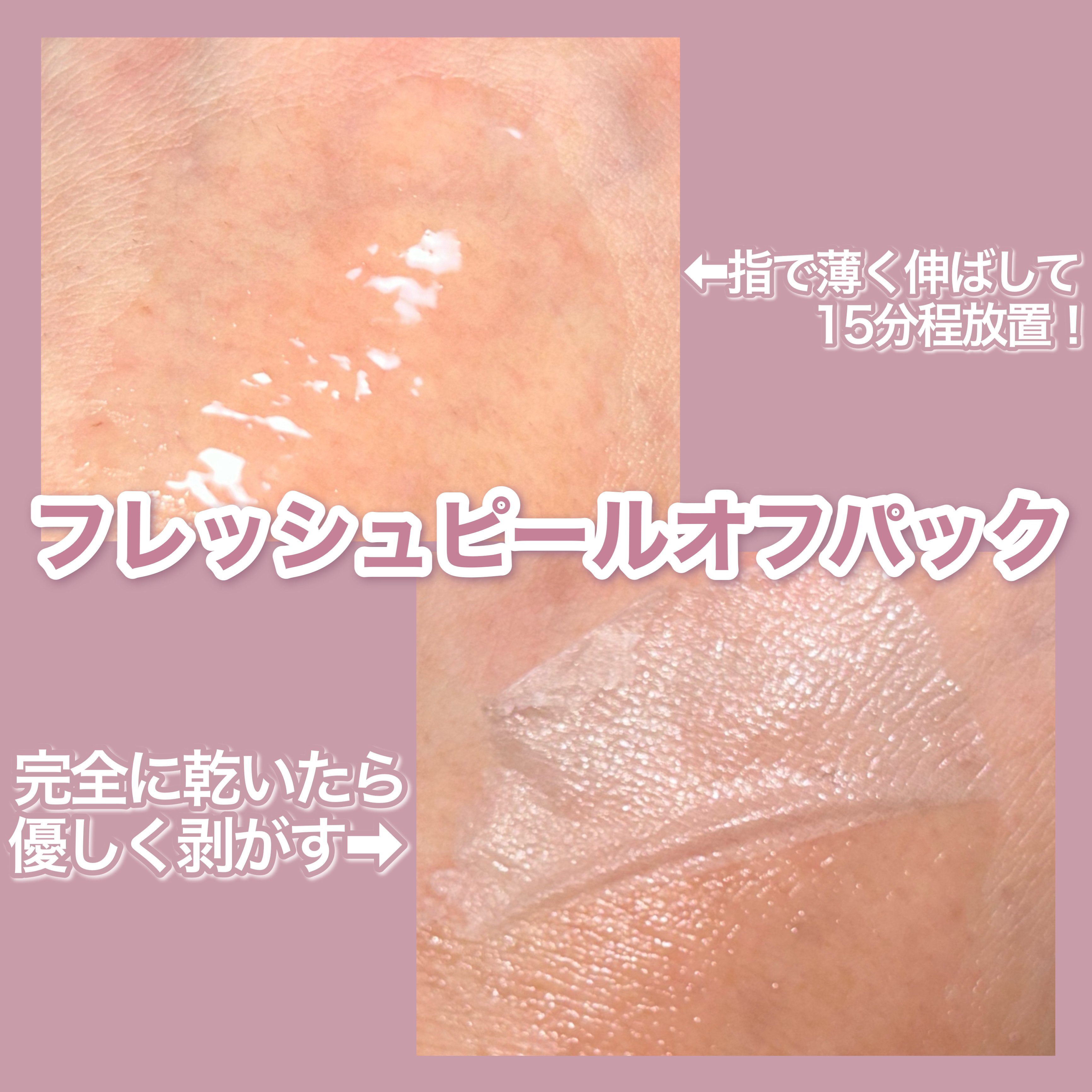 ももぷり フレッシュピールオフパック/ももぷり/ピーリングを使ったクチコミ（3枚目）