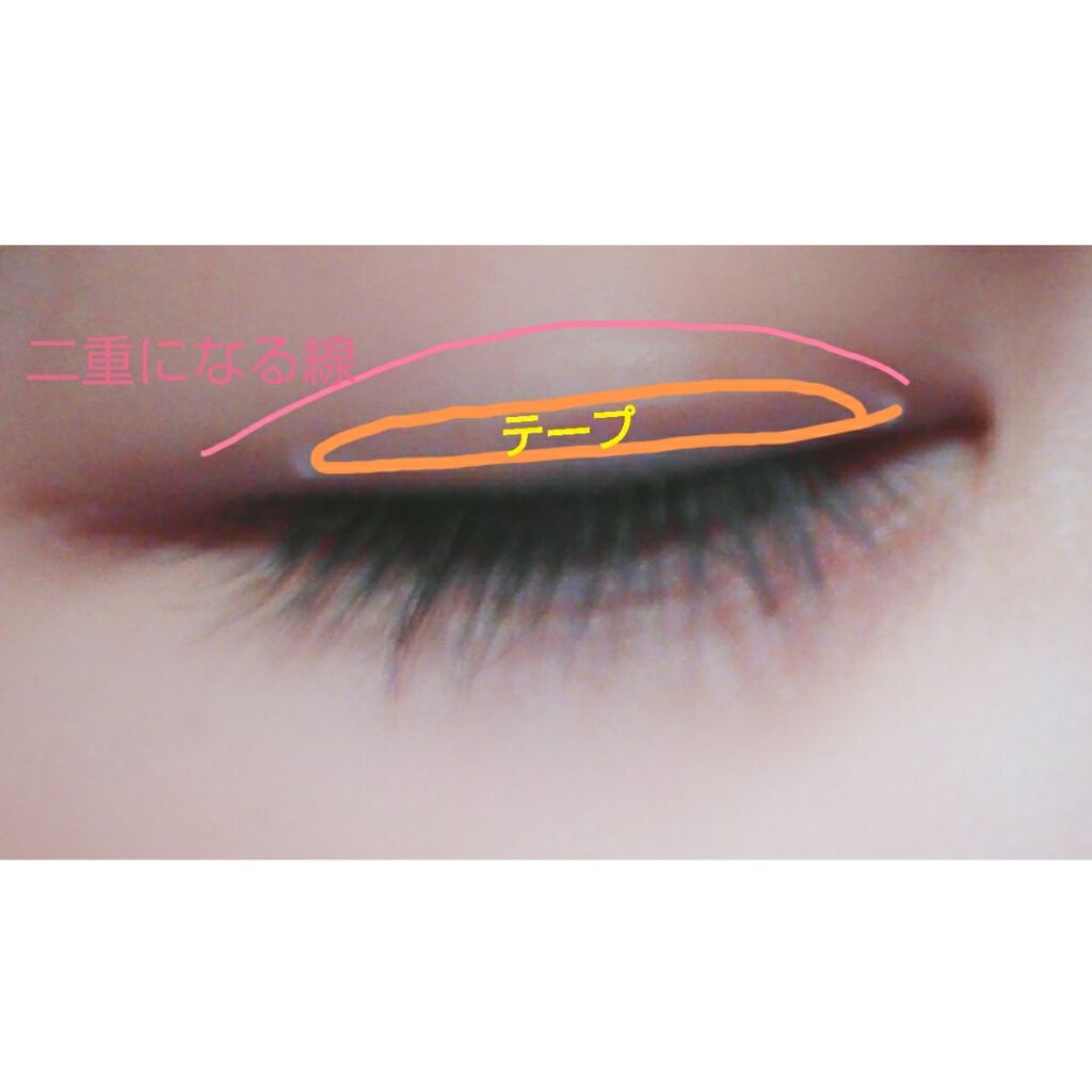 アイトーク/アイトーク/二重まぶた用アイテムを使ったクチコミ（2枚目）