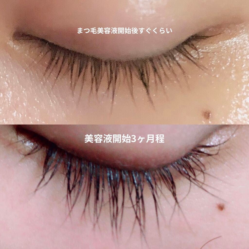 DHCアイラッシュトニック/DHC/まつげ美容液を使ったクチコミ(2枚目)