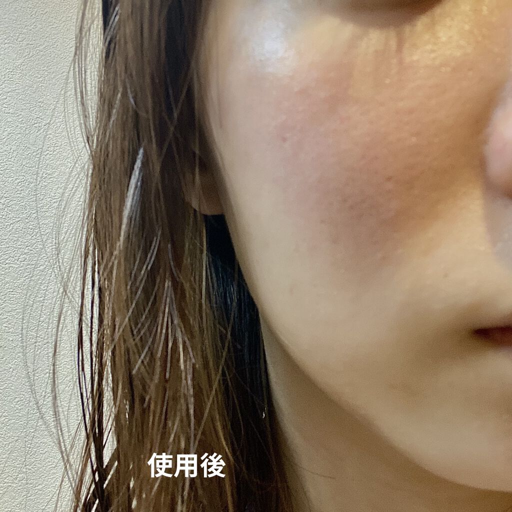 ドクタージャルト シカペア クリーム （第2世代）/Dr.Jart＋/フェイスクリームを使ったクチコミ（3枚目）