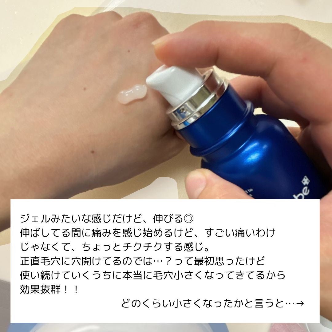 ゼロ1DAYエクソソームショット2000/MEDICUBE/美容液を使ったクチコミ(5枚目)
