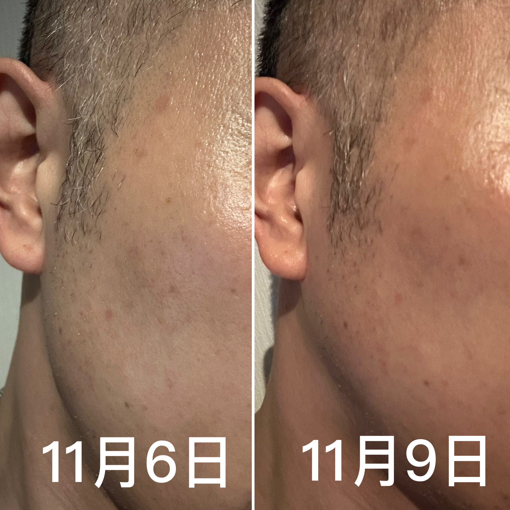 CICA デイリースージングマスク/VT/シートマスク・パックを使ったクチコミ（3枚目）