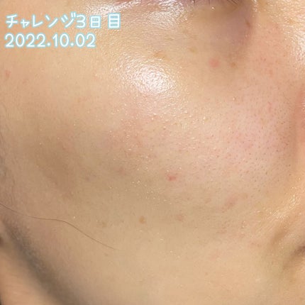 めも on LIPS 「【メモ】毛穴目立たせたくない!1週間チャレンジスキンケア🤍毛穴..」(4枚目)