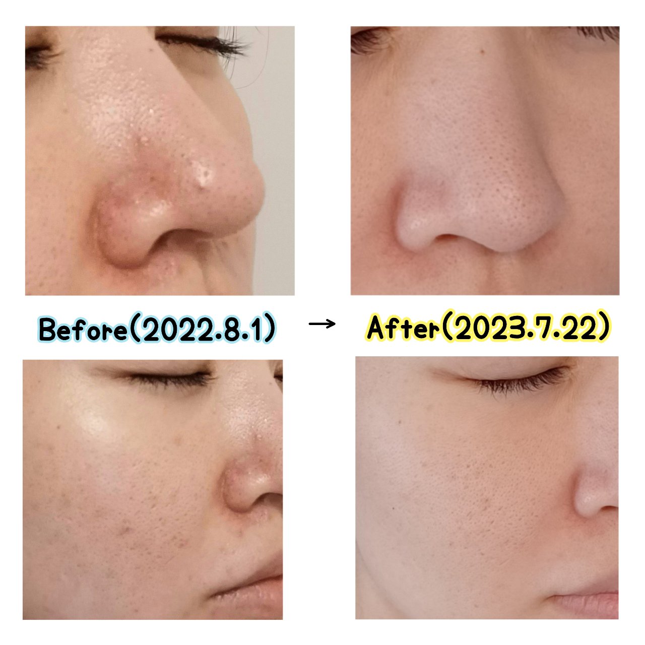 ラゴム ジェルトゥウォーター クレンザー(朝用洗顔)/LAGOM /その他洗顔料を使ったクチコミ（2枚目）