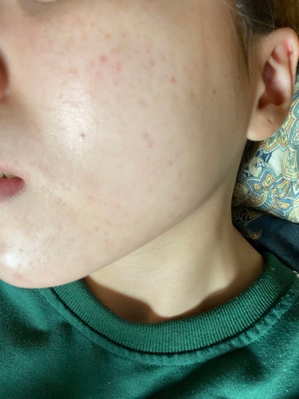 モイスチャー リッチローション(とてもしっとり)/アルージェ/化粧水を使ったクチコミ(4枚目)