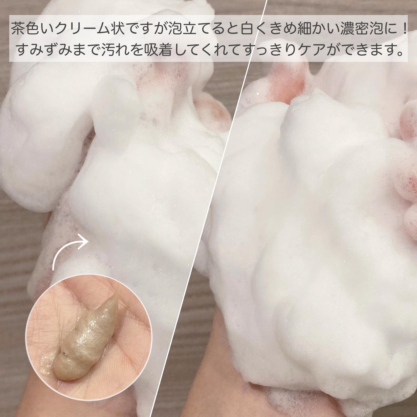 センテラ アンプルフォーム/SKIN1004/洗顔フォームを使ったクチコミ(2枚目)