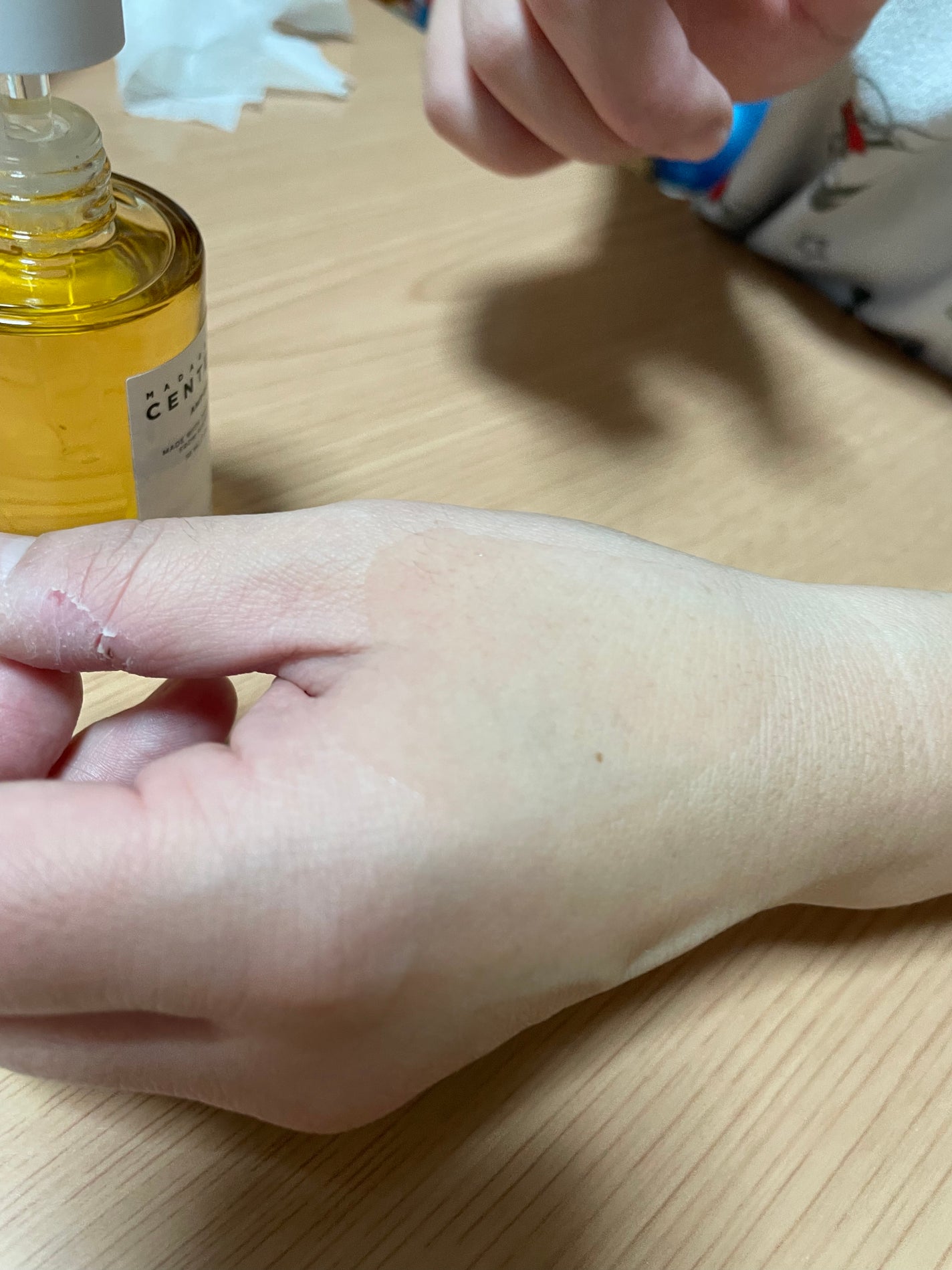 センテラ アンプル/SKIN1004/美容液を使ったクチコミ(3枚目)