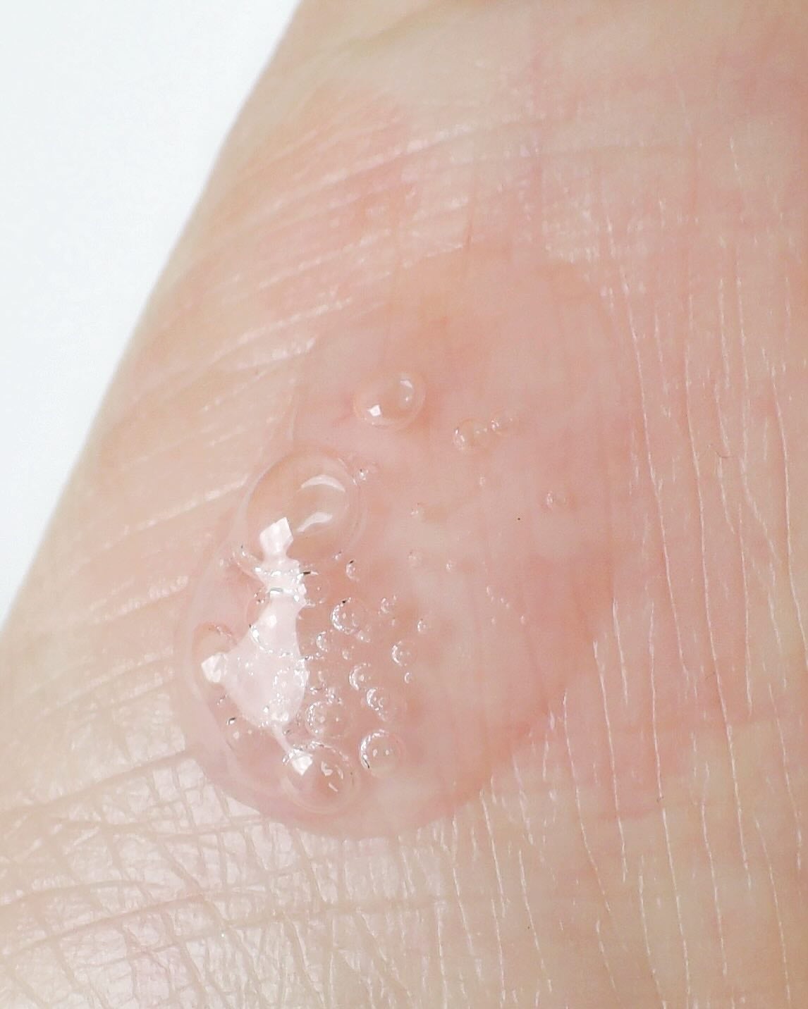 ピンクトーニング™︎ディープインショットアンプル/CNP Laboratory/美容液を使ったクチコミ(4枚目)