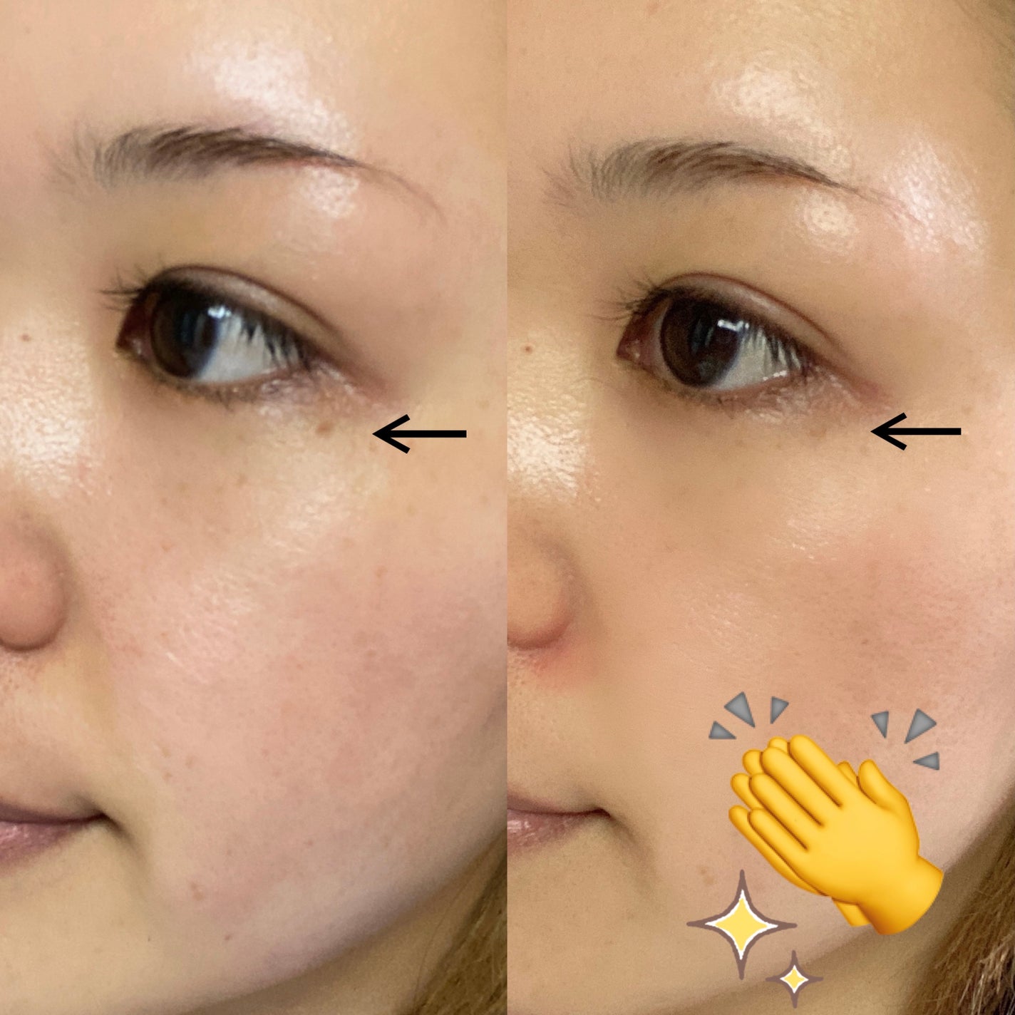 LongLife the VC50NMN+/BE-MAX/美容液を使ったクチコミ(6枚目)