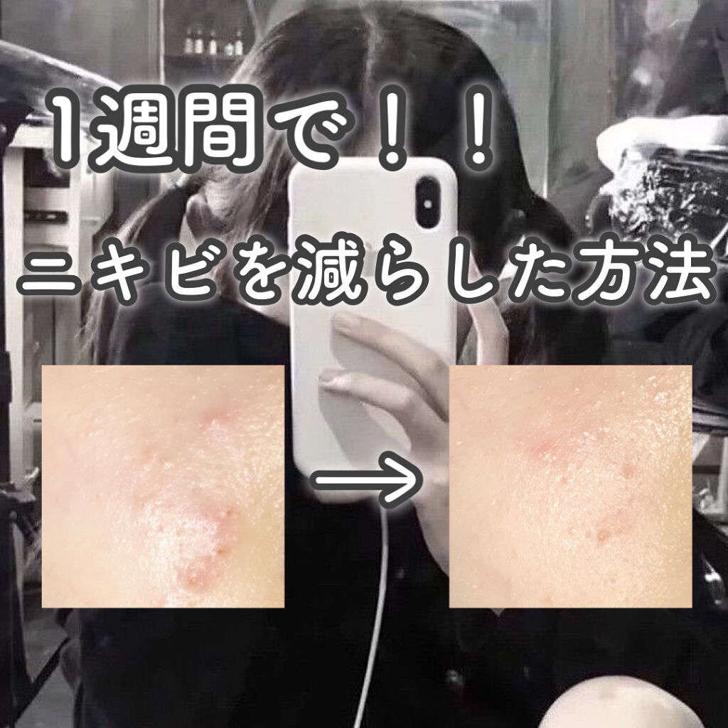 明色美顔水 薬用化粧水/美顔/化粧水を使ったクチコミ（1枚目）