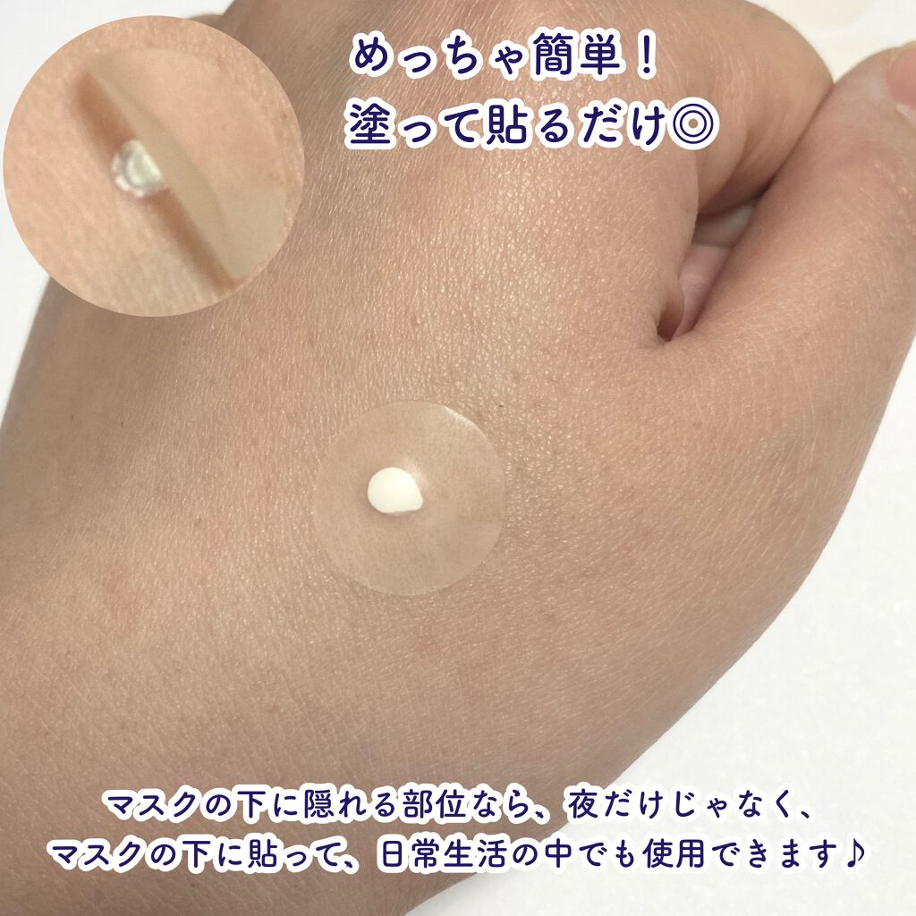 薬用ニキビケア スポッツクリーム/アクネスラボ/フェイスクリームを使ったクチコミ(6枚目)