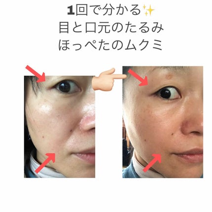 ガルバニック スパシステム2/ニュースキン/その他キットセットを使ったクチコミ(3枚目)