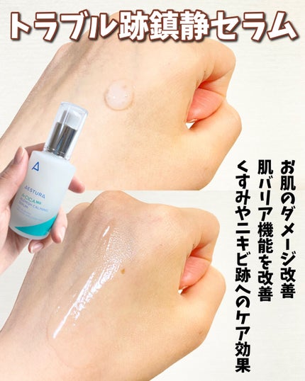 ã¿ãð§žã¹ãã³ã±ã¢ãªã¿ã¯ on LIPS ããéåœã§å®å£²ïŒèé®éã·ãªãŒãºã®ã¹ãã³ã±ã¢2ãéåœã§äººæ°ã®ãã©ã..ãïŒ4æç®ïŒ