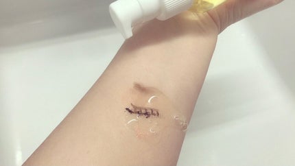 フリミースキンケアクレンジング/FURIME/クレンジングジェルを使ったクチコミ(2枚目)