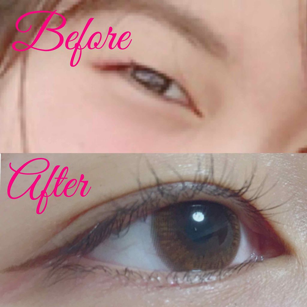 ワンダーアイリッドテープ Extra/D-UP/二重まぶた用アイテムを使ったクチコミ(1枚目)