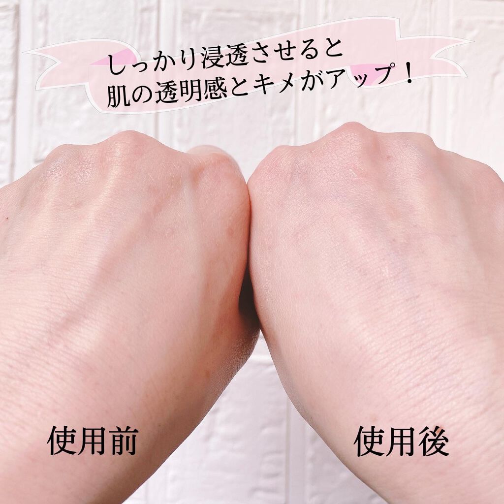 クリアフル ローションM(しっとりタイプ)/オルビス/化粧水を使ったクチコミ（3枚目）