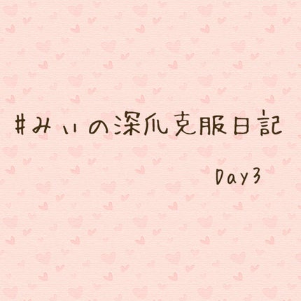 ネイルサポート Na/ネイルネイル/ネイルトップコートを使ったクチコミ(1枚目)