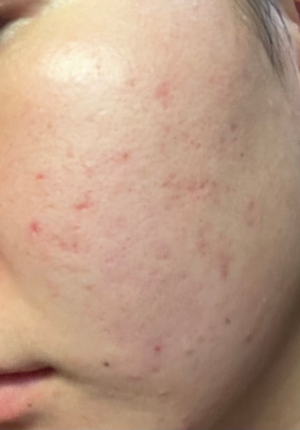 を使ったクチコミ(1枚目)