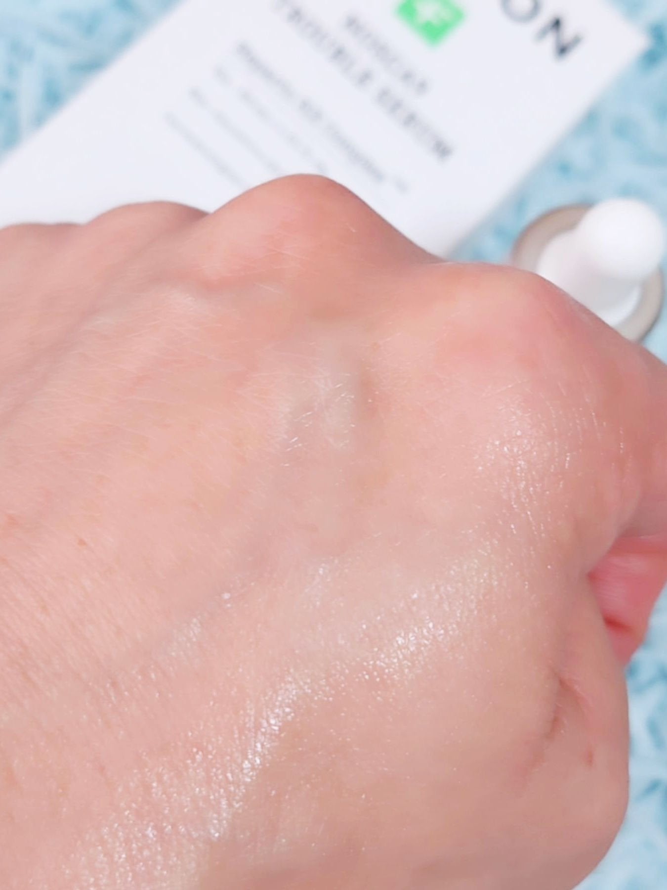 ノスカナイン トラブル セラム/FATION/美容液を使ったクチコミ(6枚目)