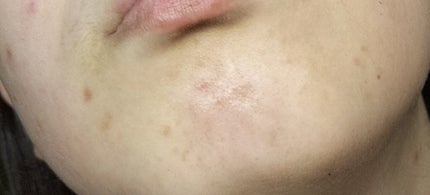 高浸透うるおい化粧液/SQS/化粧水を使ったクチコミ(5枚目)