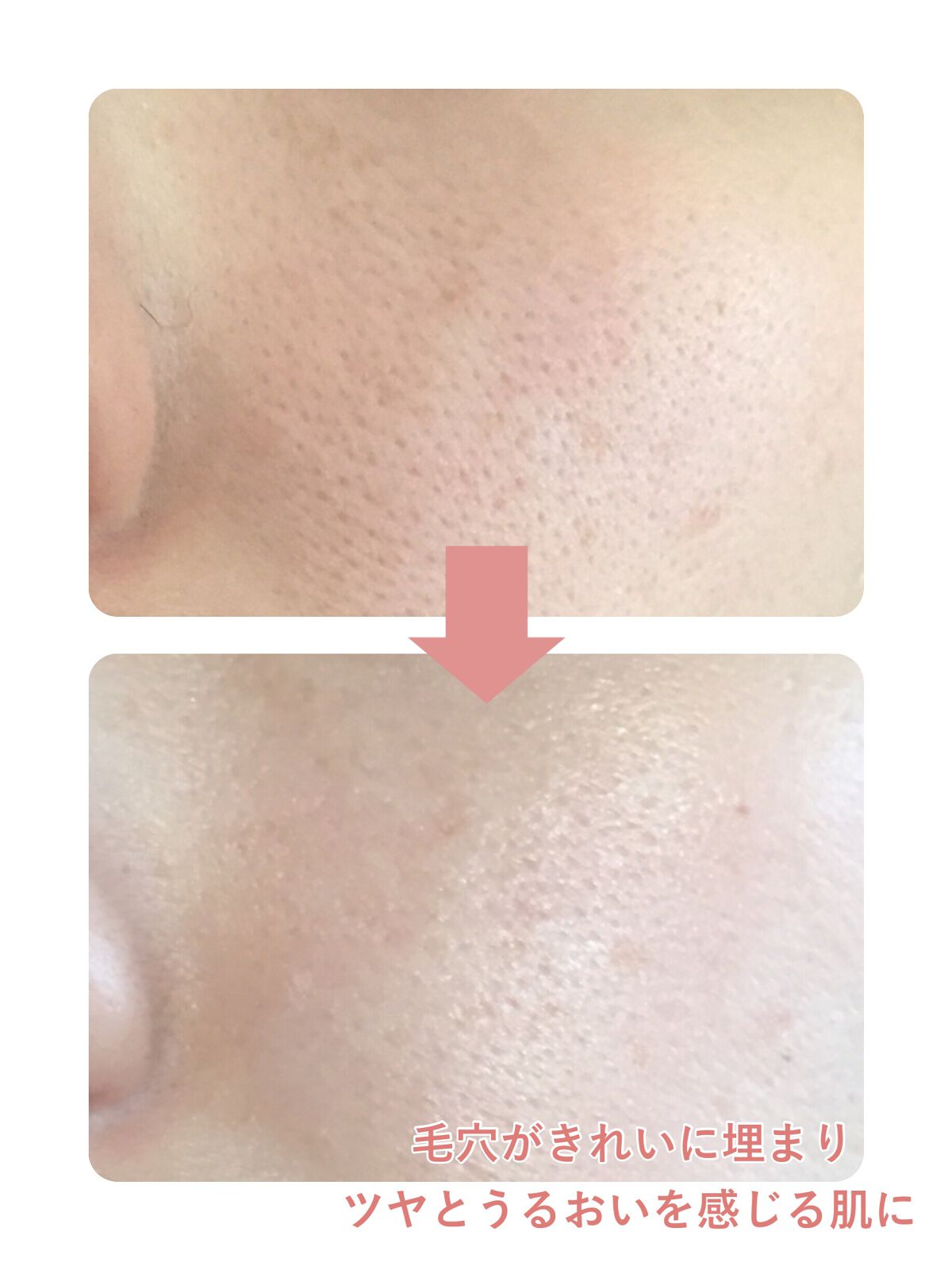 UVイデア XL プロテクショントーンアップ ローズ/ラ ロッシュ ポゼ/日焼け止めクリームを使ったクチコミ(6枚目)