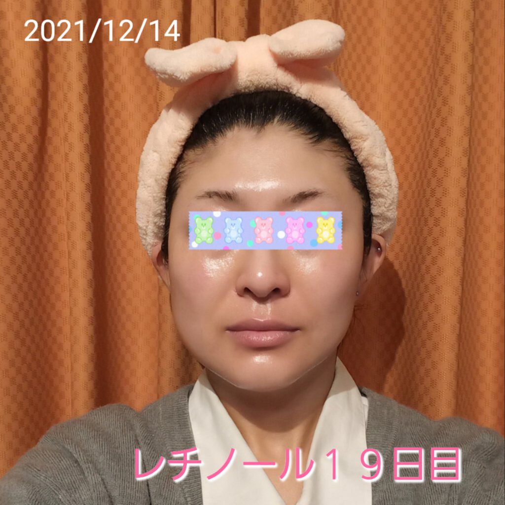 スーパーリンクルセラムVA/KISO/美容液を使ったクチコミ（1枚目）