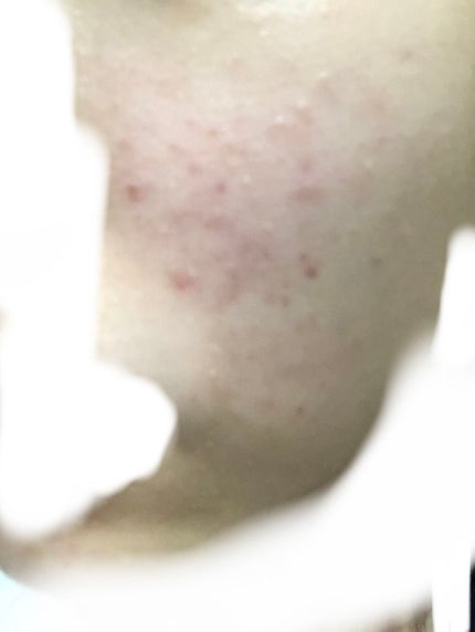 を使ったクチコミ(1枚目)